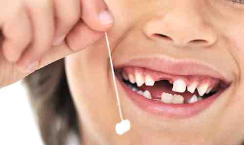 Молочные зубы - нужны ли уход и лечение?